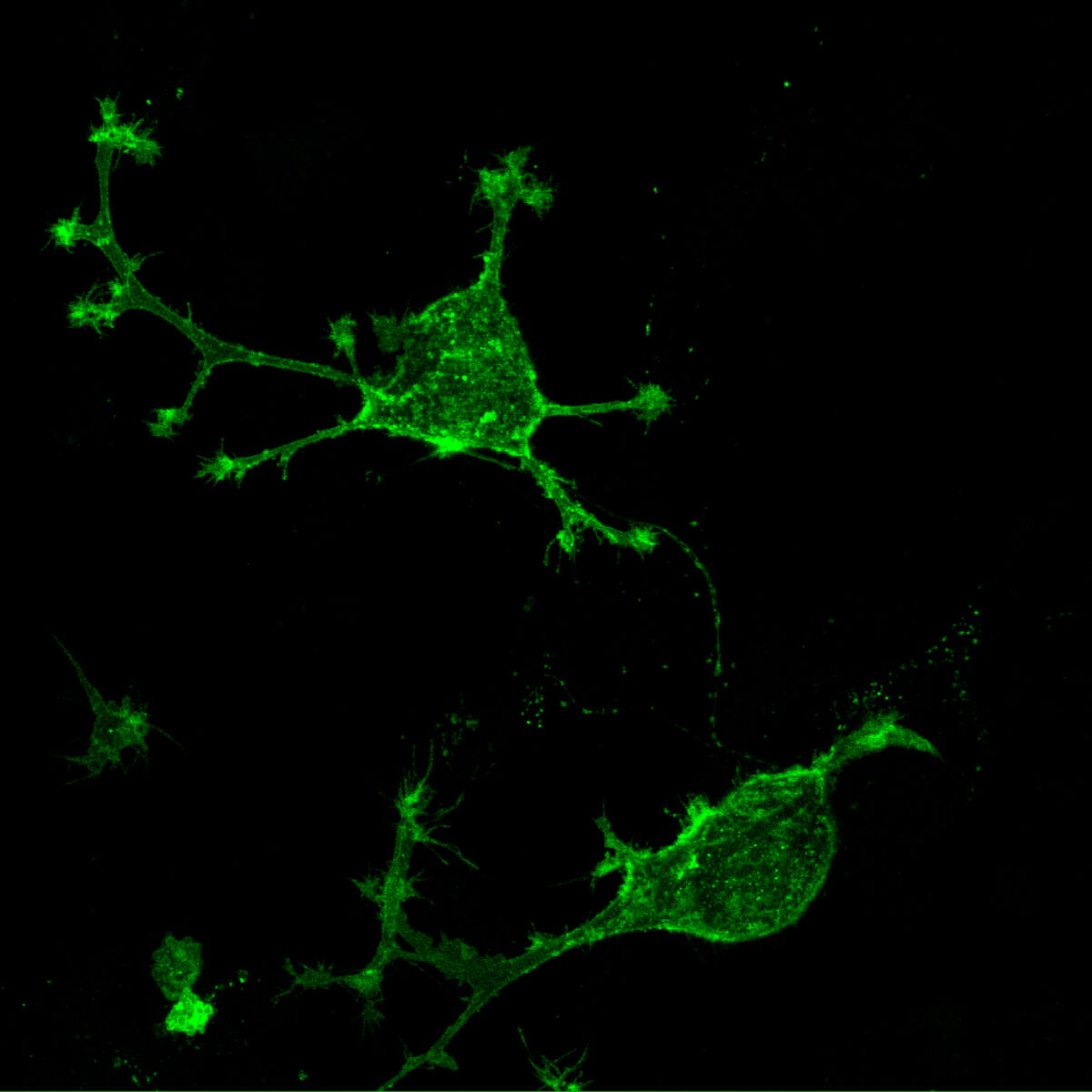 GFP transfected cells