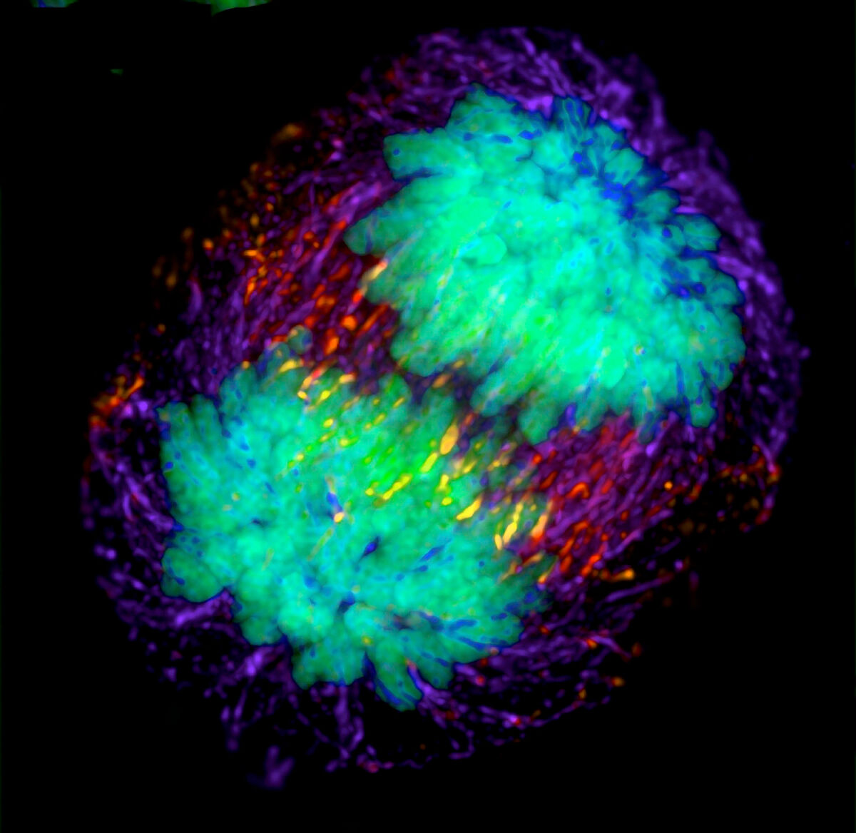 HeLa cell in anaphase — the origin specimen