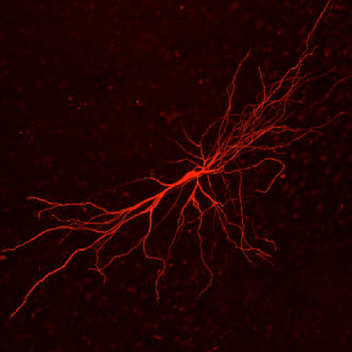 Hippocampal neuron, red channel